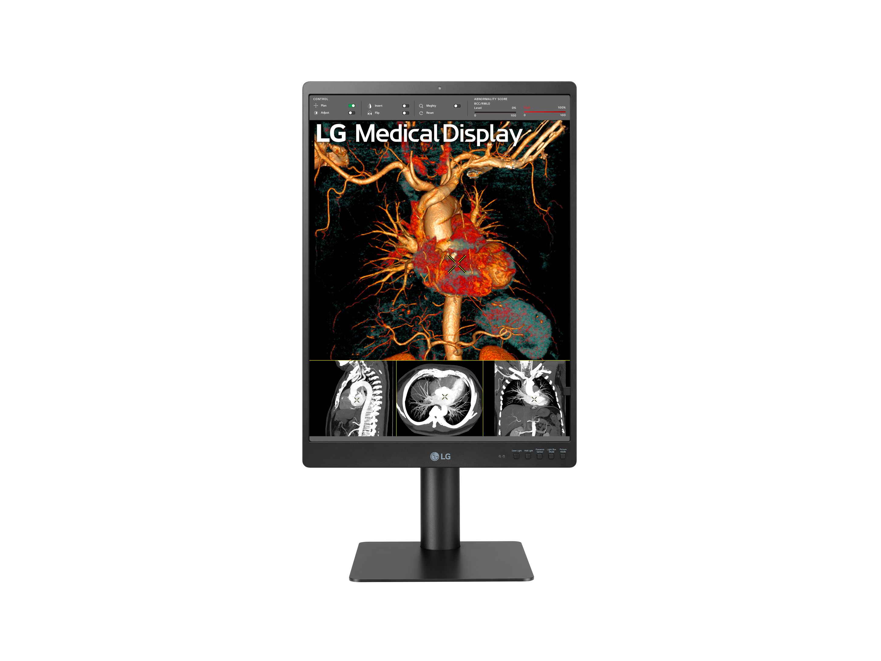 21.3 inch 3mp diagnostic monitor