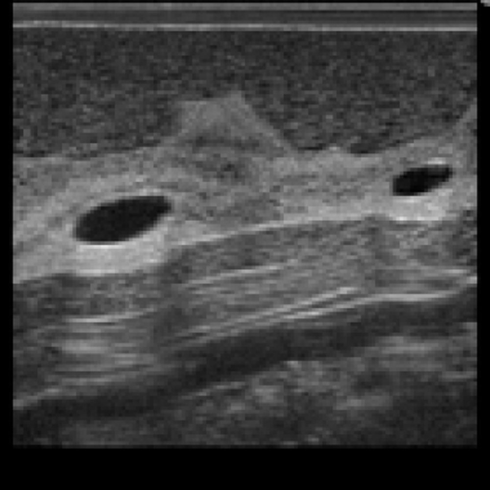 Breast Ultrasound Examination Phantom 
"BREAST FAN"