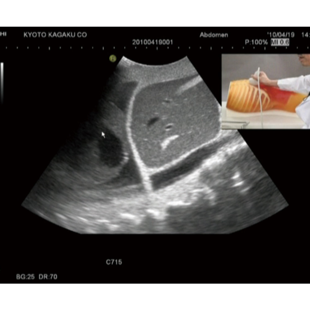 FAST/Acute Abdomen Phantom "FAST/ER FAN"