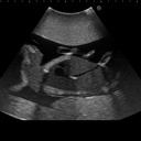 Fetus Ultrasound Examination Phantom 
"SPACE FAN-ST"