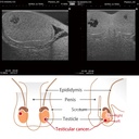 Scrotal Ultrasound Phantom