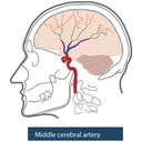 Angiographic CT Head Phantom ACS