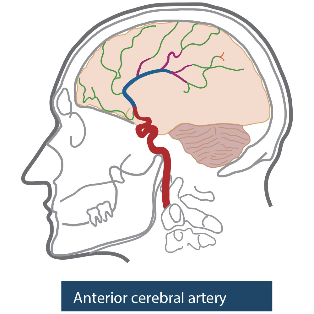 Angiographic CT Head Phantom ACS