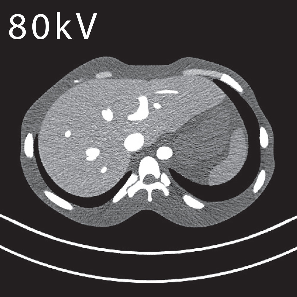 CT Abdomen Phantom