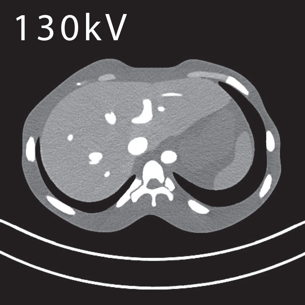 CT Abdomen Phantom