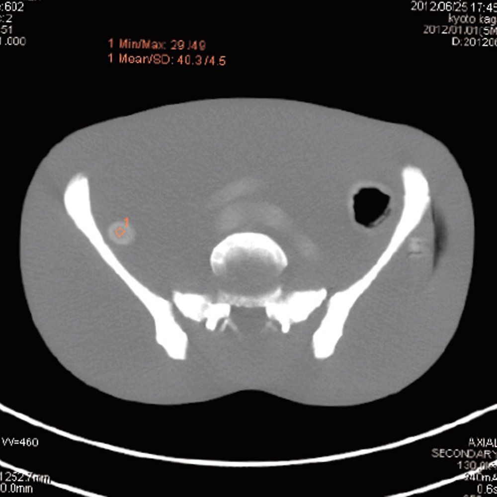 CT Whole Body Phantom - With Pathologies