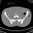 CT Whole Body Phantom - With Pathologies