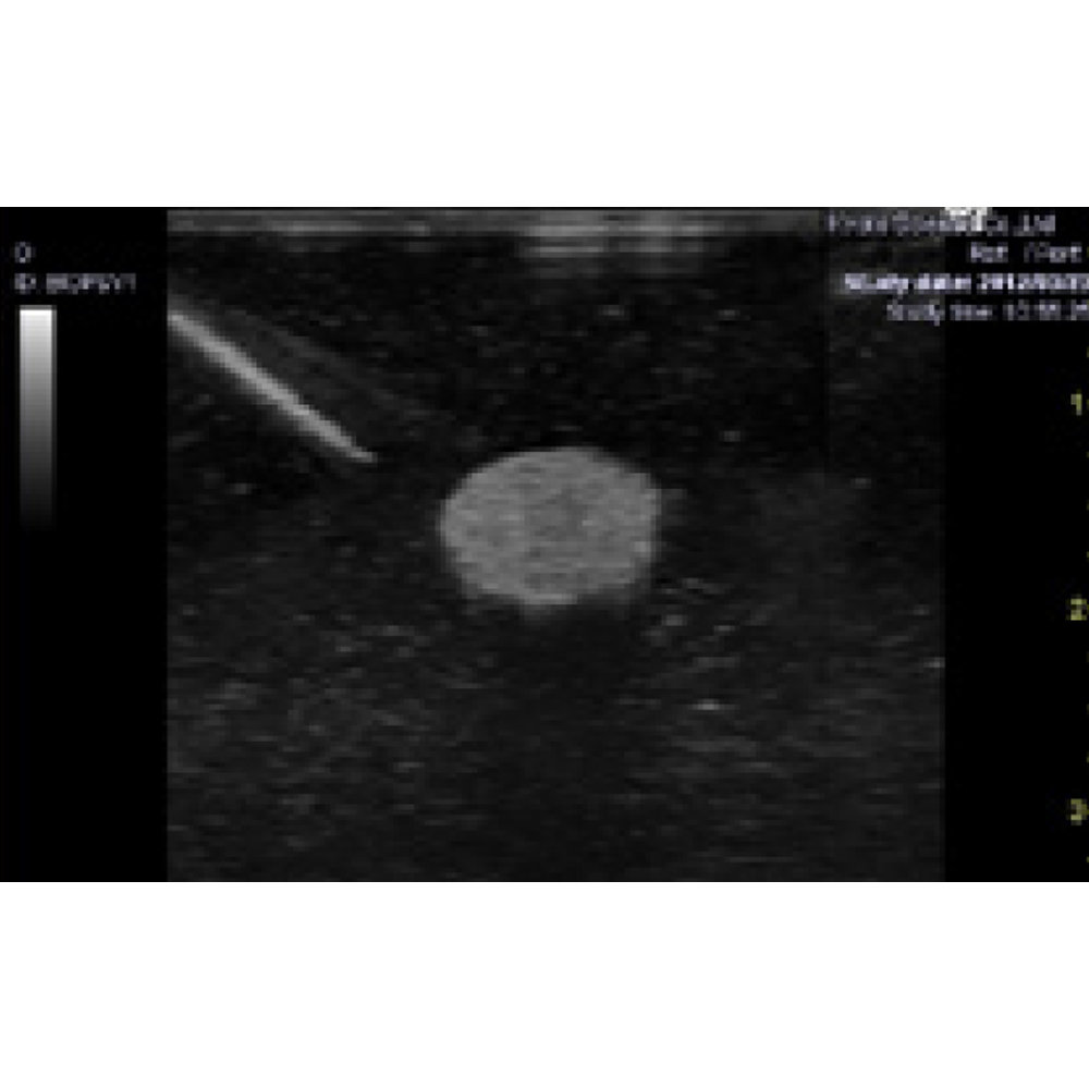 Ultrasound-Guided Breast Biopsy Phantom
Transparent set