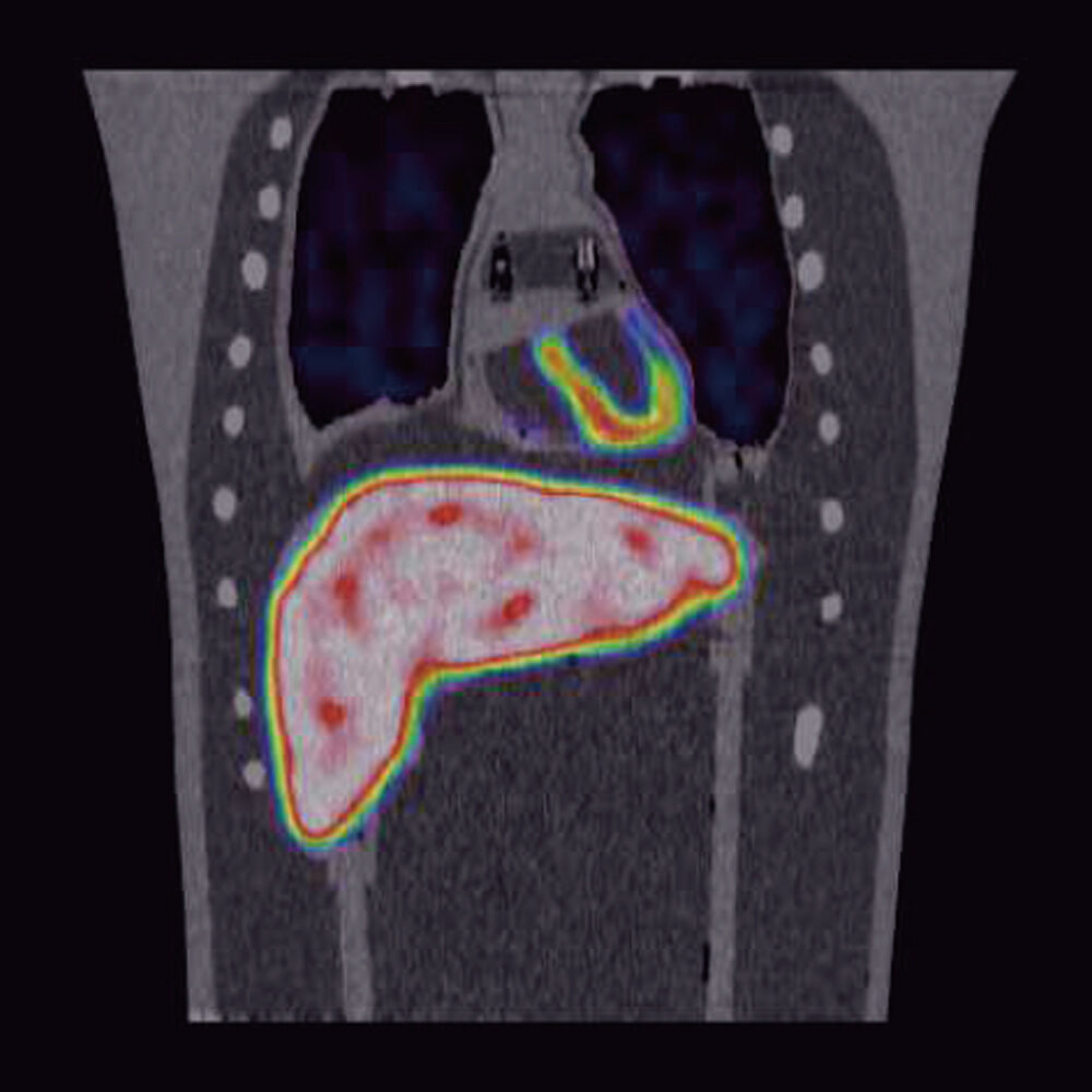 Thorax Phantom PET/SPECT