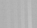 QUART DSA Digital Subtraction Angiography QA Test Phantom